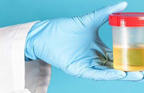 Αίμα στα ούρα